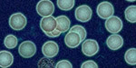 Blood Analysis
